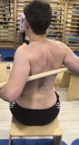 SEAS Method – Brooklyn Scoliosis Therapy